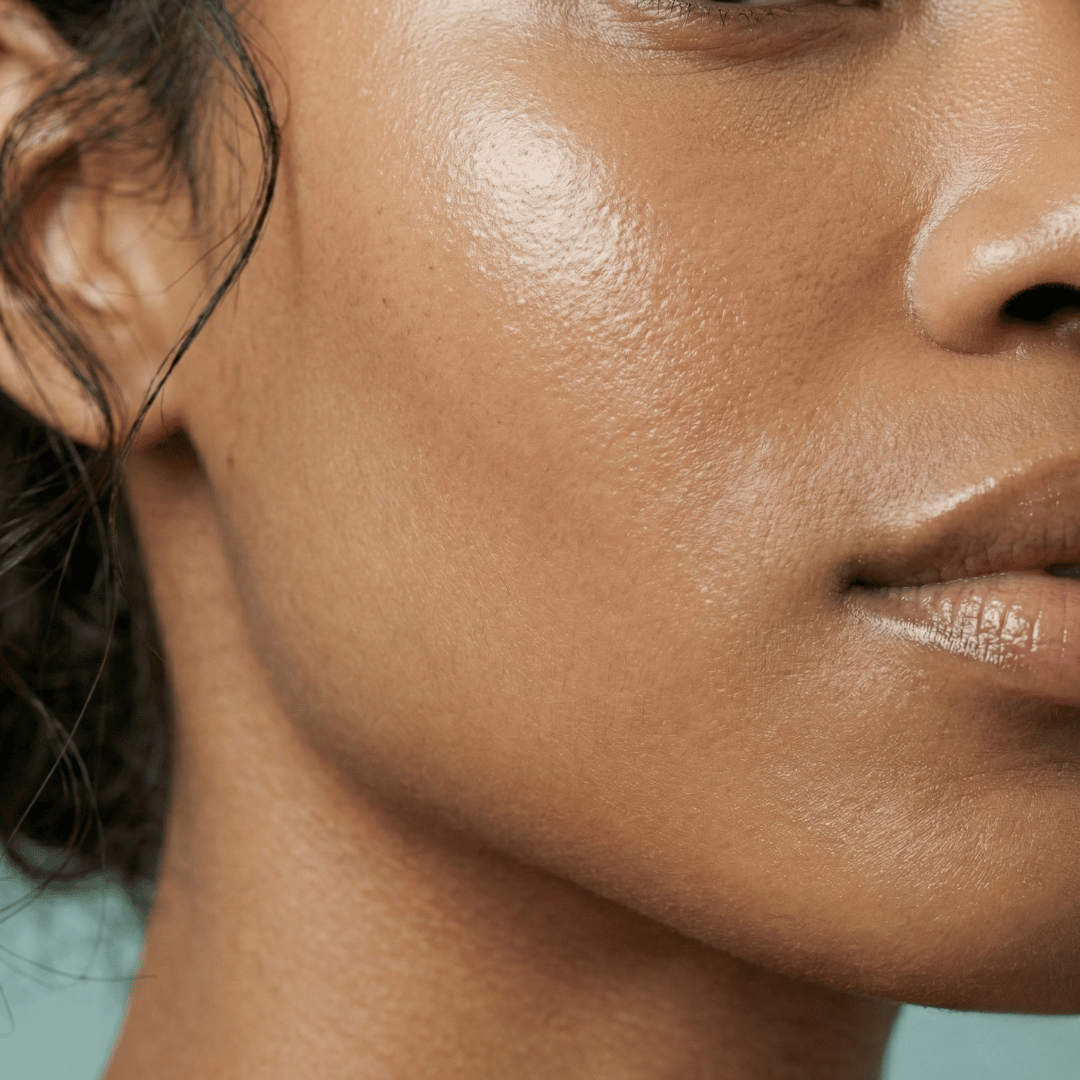 Extreme close-up beauty shot of a Black woman’s skin showing healthy texture, hydration, and even tone. Focus on cheek and jaw area.